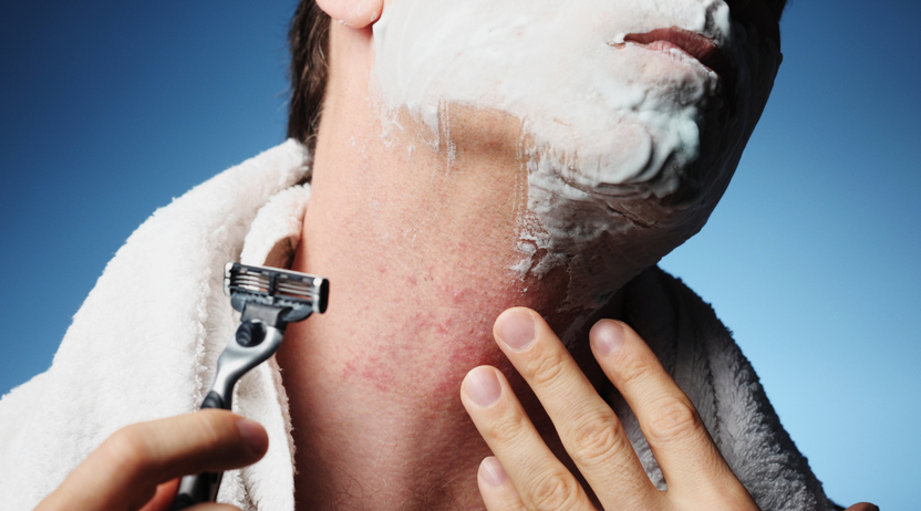 How To Get Rid Of Razor Rash How to Get Rid of Razor Burn for Good - Men’s Shaving Tips